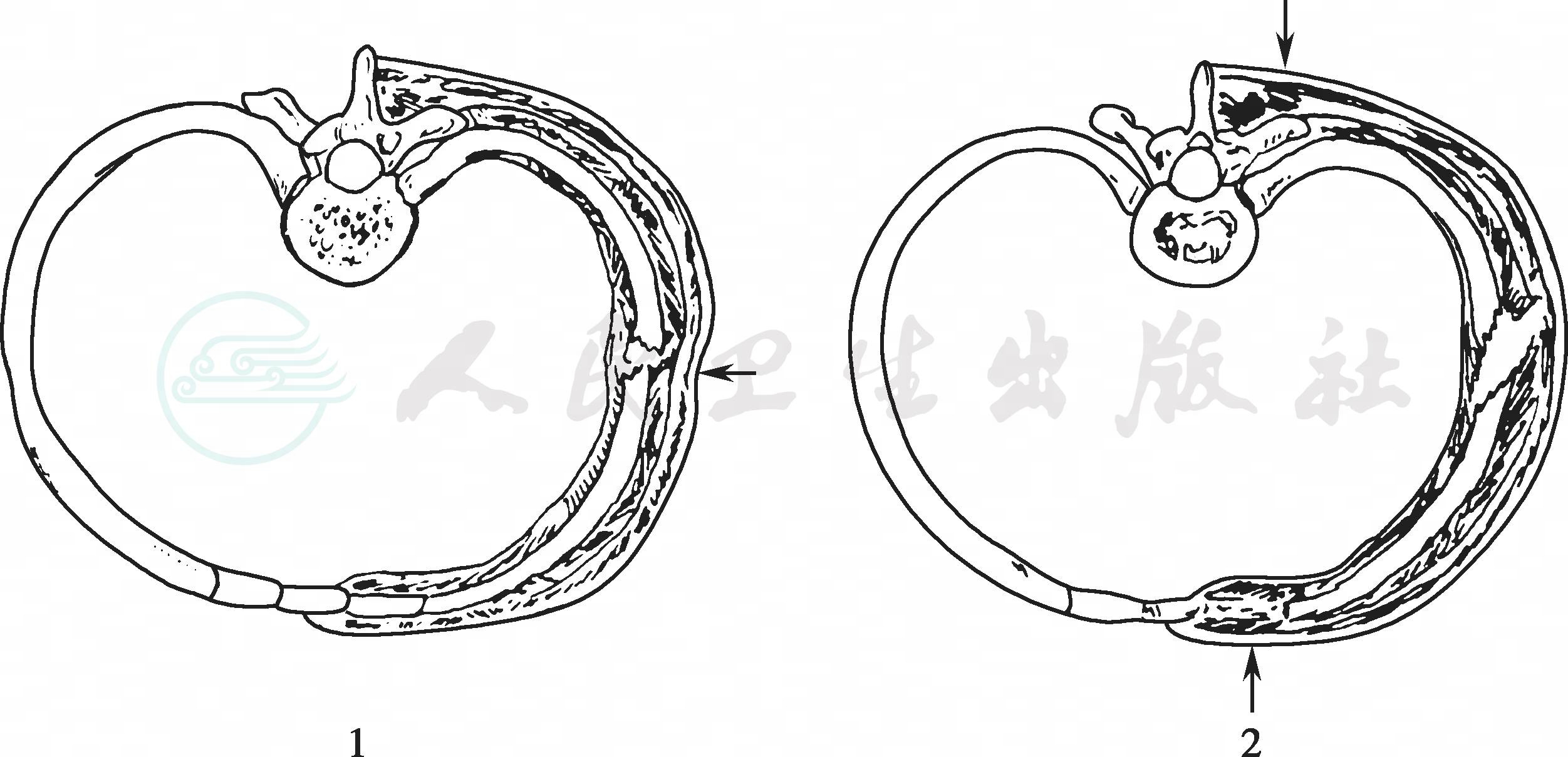 默认分类